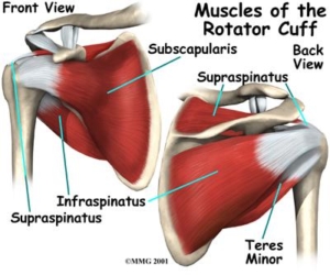 a) The rotator cuff is partially thickened, torn and laminated, and