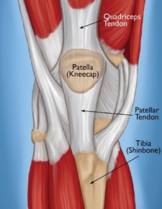 What is Patellar Tendonitis? - Dr. Roger Chams